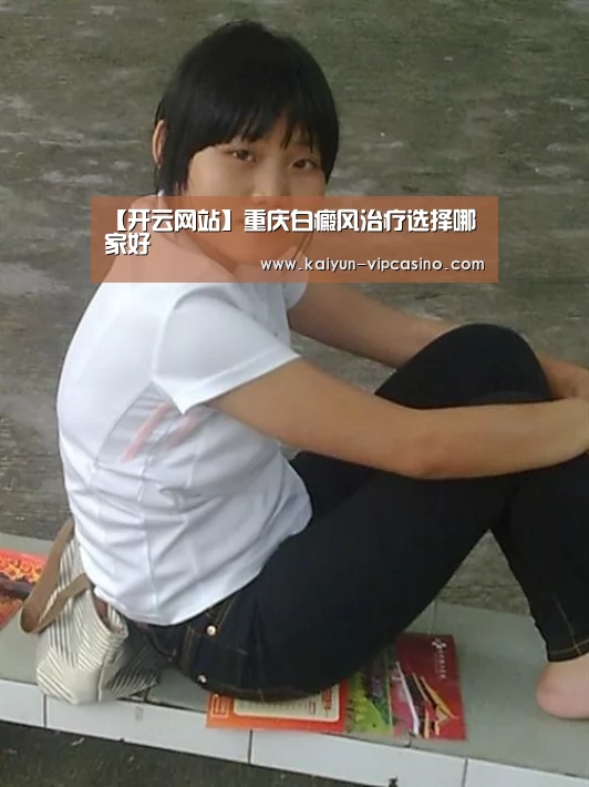 【开云网站】重庆白癜风治疗选择哪家好(图4) 开云推荐